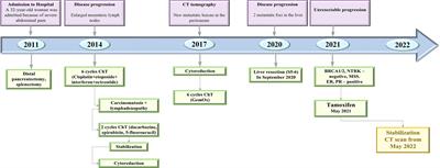 Endocrine therapy for metastatic solid pseudopapillary neoplasm of the pancreas: A case report